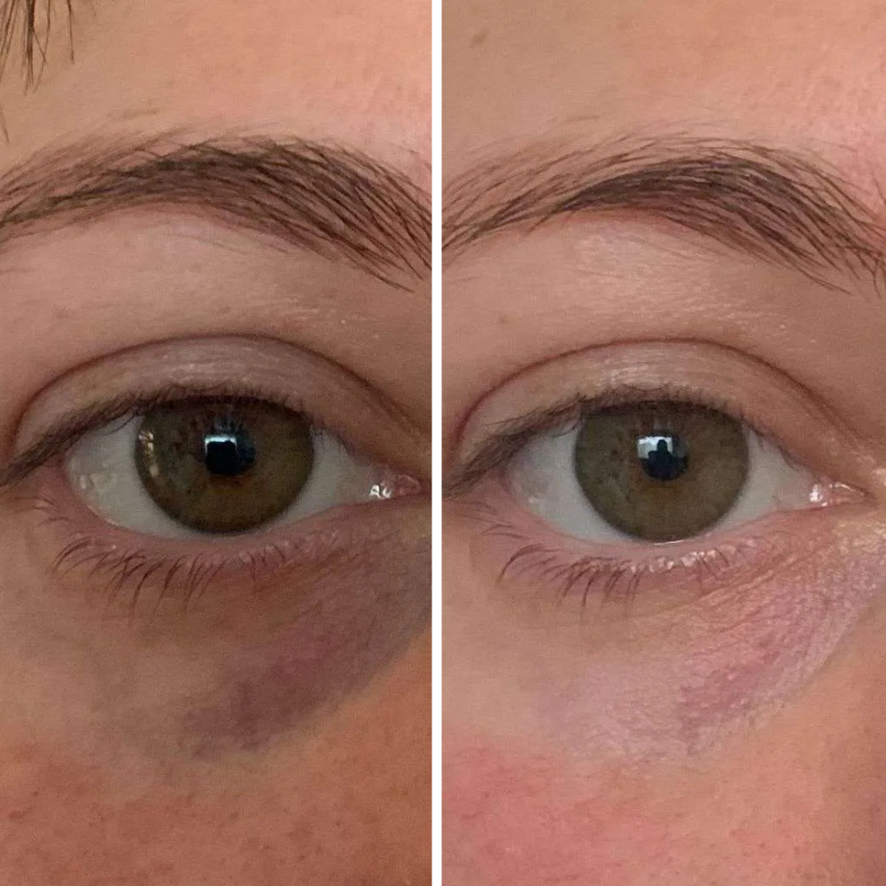 Nura - Avocado Collagen Eye Mask