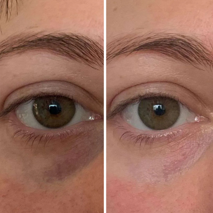 Nura - Avocado Collagen Eye Mask